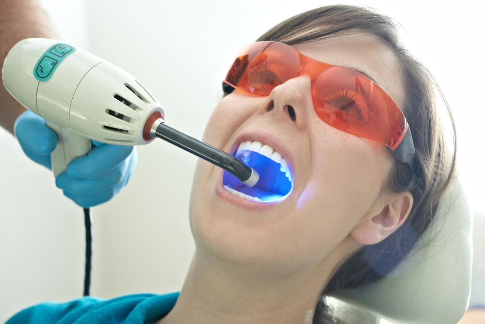Как отбеливают зубы в стоматологии?