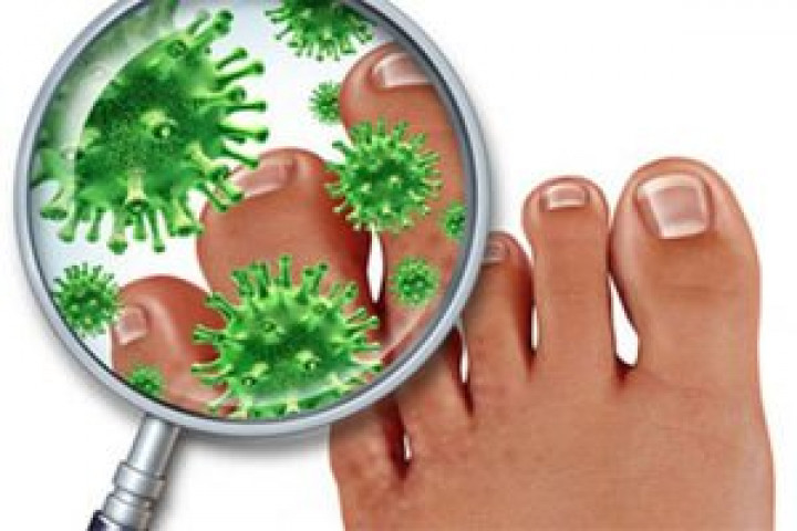 Мазь Дерматизон: эффективное средство в помощь в борьбе с грибковыми инфекциями кожи