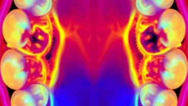 Лечение кариеса методом Icon: когда зуб спасают без сверления