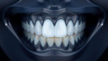 Эстетическая реставрация зубов: вернуть улыбке естественность без лишней боли и риска