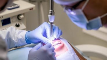 Импланты Osstem: как проходит установка и почему многие пациенты выбирают именно эту систему